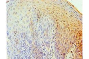 Immunohistochemistry of paraffin-embedded human tonsil tissue using ABIN7173838 at dilution of 1:100 (TNFRSF1D (AA 257-386) 抗体)