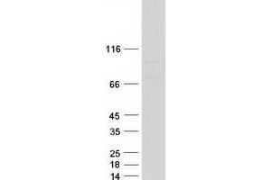 Western Blotting (WB) image for Hyaluronan-Mediated Motility Receptor (RHAMM) (HMMR) (Transcript Variant 2) protein (Myc-DYKDDDDK Tag) (ABIN2713460)