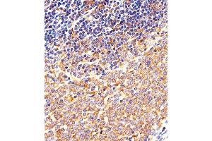 Immunohistochemical analysis of paraffin-embedded M. (CSK 抗体  (N-Term))