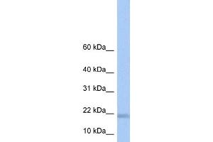 WB Suggested Anti-LOC284009 Antibody Titration: 0. (LOC284009 抗体  (N-Term))