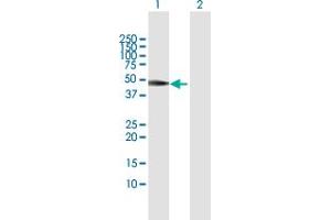 Western Blot analysis of VRK1 expression in transfected 293T cell line by VRK1 MaxPab polyclonal antibody. (VRK1 抗体  (AA 1-396))
