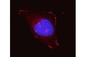 IF analysis of Grancalcin/GCA using anti-Grancalcin/GCA antibody (ABIN6719568).