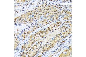 Immunohistochemistry of paraffin-embedded rat ovary using FKBP51/FKBP5 Rabbit mAb (ABIN7267213) at dilution of 1:100 (40x lens). (FKBP5 抗体)