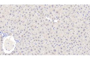 Detection of ADH1 in Mouse Liver Tissue using Polyclonal Antibody to Alcohol Dehydrogenase 1 (ADH1) (ADH1 抗体  (AA 25-228))