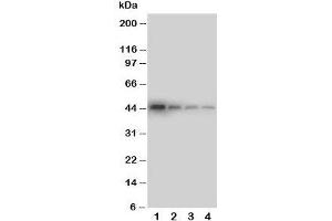 Western blot testing of DDR1 antibody and Lane 1:  recombinant human protein 10ng;  2: 5ng;  3: 2. (DDR1 抗体  (C-Term))