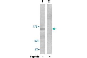 Western blot analysis of extracts from HeLa cells, using COL4A1 polyclonal antibody . (COL4A1 抗体  (AA 31-70))