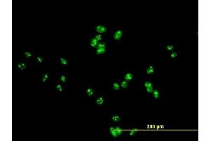 Immunofluorescence of purified MaxPab antibody to DDX47 on HeLa cell.