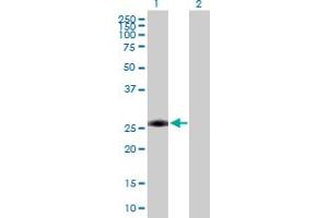 Western Blot analysis of AAAS expression in transfected 293T cell line by AAAS MaxPab polyclonal antibody. (Adracalin 抗体  (AA 1-546))