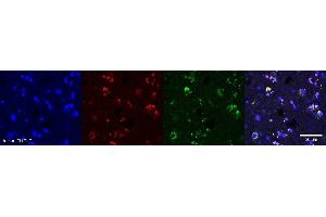 Immunohistochemistry (IHC) image for anti-Oligodendrocytic Myelin Paranodal and Inner Loop Protein (OPALIN) antibody (ABIN7456142) (OPALIN 抗体)