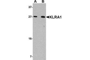 Western blot analysis of KLRA1 in 293 cell lysate with KLRA1 antibody at (A) 1 μg/ml and (B) 2 μg/ml. (KLRA1 抗体  (C-Term))