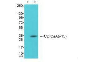Western blot analysis of extracts from cos-7 cells (Lane 2), using CDK5 (Ab-15) antiobdy. (CDK5 抗体  (Tyr15))