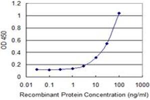 Detection limit for recombinant GST tagged PMCH is 1 ng/ml as a capture antibody. (PMCH 抗体  (AA 1-165))