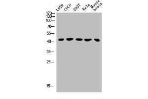 Western Blot analysis of L929 COLO 293T HELA MOUSE-brain cells using GHRH-R Polyclonal Antibody (GHRHR 抗体  (C-Term))