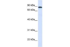 DDX1 antibody used at 1 ug/ml to detect target protein. (DDX1 抗体)