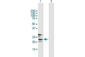 Western Blot analysis of CREG1 expression in transfected 293T cell line by CREG1 MaxPab polyclonal antibody. (CREG1 抗体  (AA 1-220))