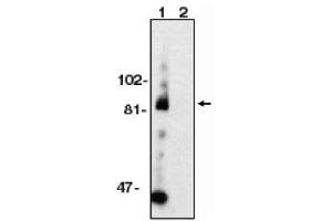 Image no. 1 for anti-ADAM Metallopeptidase Domain 10 (ADAM10) (AA 732-748) antibody (ABIN264988)
