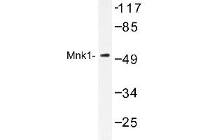 Image no. 1 for anti-MAP Kinase Interacting serine/threonine Kinase 1 (MKNK1) antibody (ABIN272252) (MKNK1 抗体)