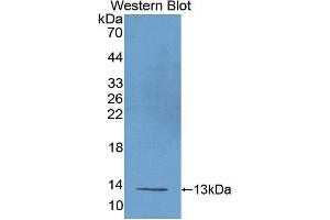 Western Blotting (WB) image for anti-Uncoupling Protein 1 (Mitochondrial, Proton Carrier) (UCP1) (AA 179-296) antibody (ABIN2905048)