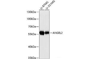 Western blot analysis of extracts of various cell lines using ANGEL2 Polyclonal Antibody at dilution of 1:3000. (ANGEL2 抗体)