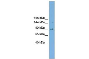 TACC3 antibody used at 1 ug/ml to detect target protein. (TACC3 抗体  (Middle Region))