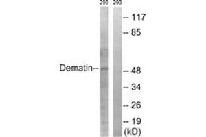 Western blot analysis of extracts from 293 cells, using Dematin (Ab-403) Antibody.
