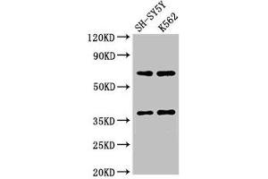 Western Blot Positive WB detected in: SH-SY5Y whole cell lysate, K562 whole cell lysate All lanes: CTSH antibody at 2. (Cathepsin H 抗体  (AA 116-219))