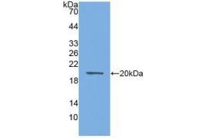 Detection of Recombinant AQP4, Mouse using Polyclonal Antibody to Aquaporin 4 (AQP4) (Aquaporin 4 抗体  (AA 177-304))