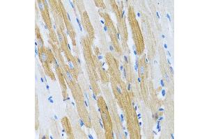 Immunohistochemistry of paraffin-embedded rat heart using WFDC2 antibody at dilution of 1:100 (40x lens).