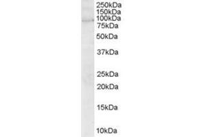 Image no. 1 for anti-rho Guanine Nucleotide Exchange Factor (GEF) 4 (ARHGEF4) (N-Term) antibody (ABIN374361) (ARHGEF4 抗体  (N-Term))