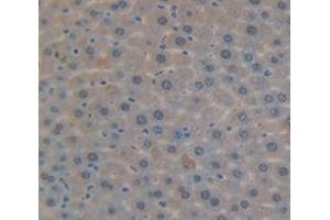 Used in DAB staining on fromalin fixed paraffin- embedded Kidney tissue (DDB2 抗体  (AA 212-407))