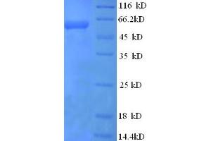 Fatty Acid Binding Protein 9, Testis (FABP9) (AA 22-555) protein (His-SUMO Tag)