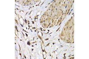 Immunohistochemistry (IHC) image for anti-ISG15 Ubiquitin-Like Modifier (ISG15) (AA 1-165) antibody (ABIN3021653) (ISG15 抗体  (AA 1-165))