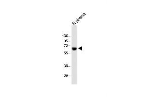 Anti-T Antibody (Center) at 1:2000 dilution + Rat plasma whole lysate Lysates/proteins at 20 μg per lane. (PLAT 抗体  (AA 371-399))