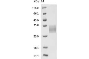 (Tris-Glycine gel) Discontinuous SDS-PAGE (reduced) with 5 % enrichment gel and 15 % separation gel.