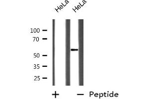 Western blot analysis of GABA-RB expression in HeLa whole cell lysates,The lane on the left is treated with the antigen-specific peptide. (GABA-RB 抗体)