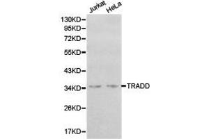 Western Blotting (WB) image for anti-TNFRSF1A-Associated Via Death Domain (TRADD) antibody (ABIN1875189) (TRADD 抗体)