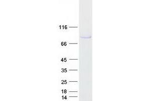 Western Blotting (WB) image for Amine Oxidase, Copper Containing 2 (Retina-Specific) (AOC2) (Transcript Variant 2) protein (Myc-DYKDDDDK Tag) (ABIN2714761)