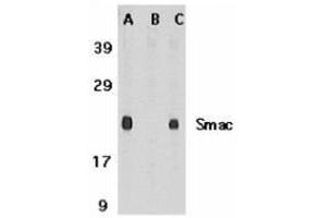 Western blot analysis of Smac in mouse heart tissue lysate in the absence (A) or presence (B) of blocking peptide and in rat heart tissue lysate with this product at 1 μg /ml. (DIABLO 抗体  (C-Term))