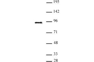 SATB2 antibody (pAb) tested by Western blot. (SATB2 抗体  (C-Term))
