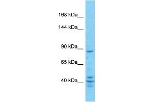 Host:  Rabbit  Target Name:  ZN160  Sample Type:  PANC1 Whole Cell lysates  Antibody Dilution:  1. (ZNF160 抗体  (C-Term))