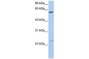 FAM3C antibody used at 1 ug/ml to detect target protein. (FAM3C 抗体  (C-Term))