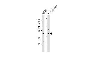 Epiregulin 抗体  (C-Term)