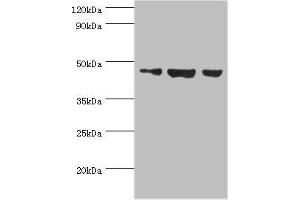 Western blot All lanes: Actin-like protein 6B antibody at 3 μg/mL Lane 1: Hela whole cell lysate Lane 2: U251 whole cell lysate Lane 3: HepG2 whole cell lysate Secondary Goat polyclonal to rabbit IgG at 1/10000 dilution Predicted band size: 47 kDa Observed band size: 47 kDa