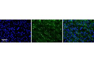 Rabbit Anti-ADCK2 Antibody  Catalog Number: ARP63131_P050 Formalin Fixed Paraffin Embedded Tissue: Human Adult Liver  Observed Staining: Membrane in bile canaliculi, strong signal, wide tissue distribution Primary Antibody Concentration: 1:100 Secondary Antibody: donkey anti-rabbit FITC Secondary Antibody Concentration: 1:200 Magnification: 20X Exposure Time: 0. (ADCK2 抗体  (Middle Region))