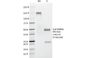 SDS-PAGE Analysis Purified CD53 Mouse Monoclonal Antibody (63-5A3). (CD53 抗体)