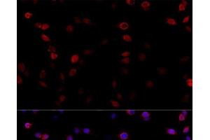 Immunofluorescence (IF) image for anti-ATP Synthase, H+ Transporting, Mitochondrial F1 Complex, beta Polypeptide (ATP5B) antibody (ABIN7010818)