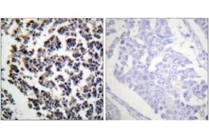 Immunohistochemistry analysis of paraffin-embedded human lymph node, using BLNK (Phospho-Tyr96) Antibody. (B-Cell Linker 抗体  (pTyr96))