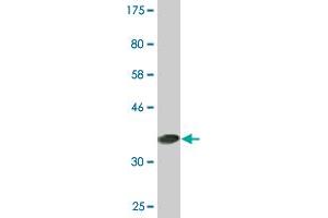 Western Blot detection against Immunogen (37. (PCTP 抗体  (AA 106-214))