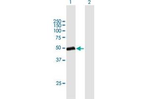 Western Blot analysis of GC expression in transfected 293T cell line by GC MaxPab polyclonal antibody. (Vitamin D-Binding Protein 抗体  (AA 1-474))