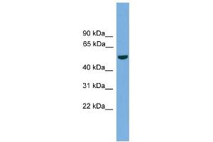 WB Suggested Anti-TMPRSS4 Antibody Titration:  0. (TMPRSS4 抗体  (N-Term))